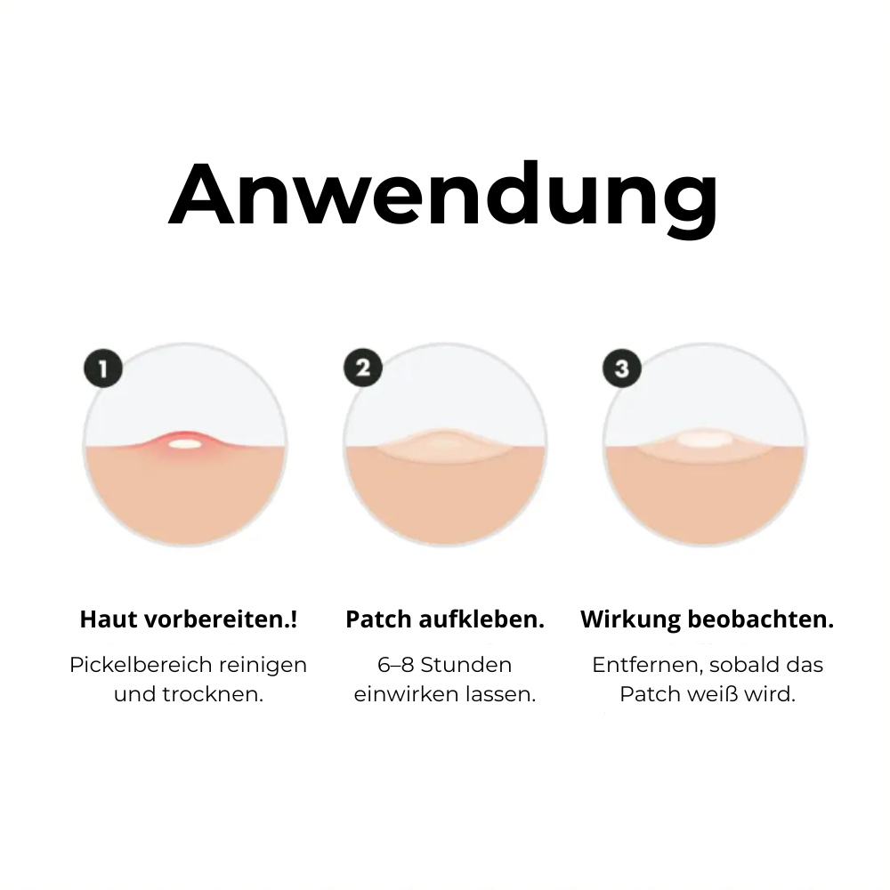Mighty Patch™ | Hero Cosmetics: ein Hydrocolloid-Akne-Patch