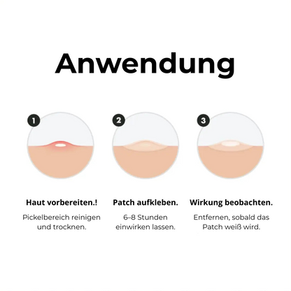 Mighty Patch™ | Hero Cosmetics: ein Hydrocolloid-Akne-Patch