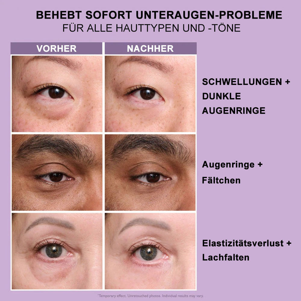 Perfection Thomas Roth™ | Instant Eye Lift Crème