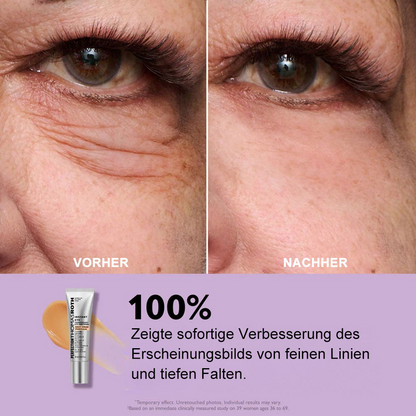 Perfection Thomas Roth™ | Instant Eye Lift Crème